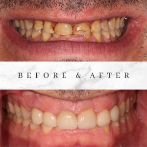 Before and after photos