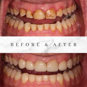 Before and after photos
