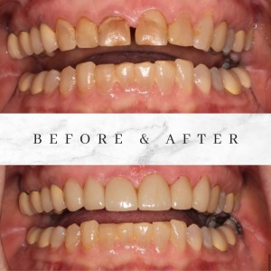 Before and after photos