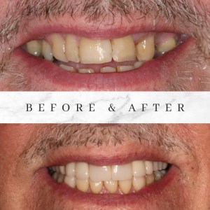 Before and after photos