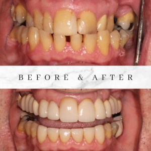 Before and after photos