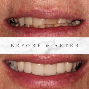 Before and after photos