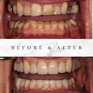 Before and after photos