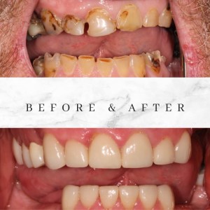 Before and after photos